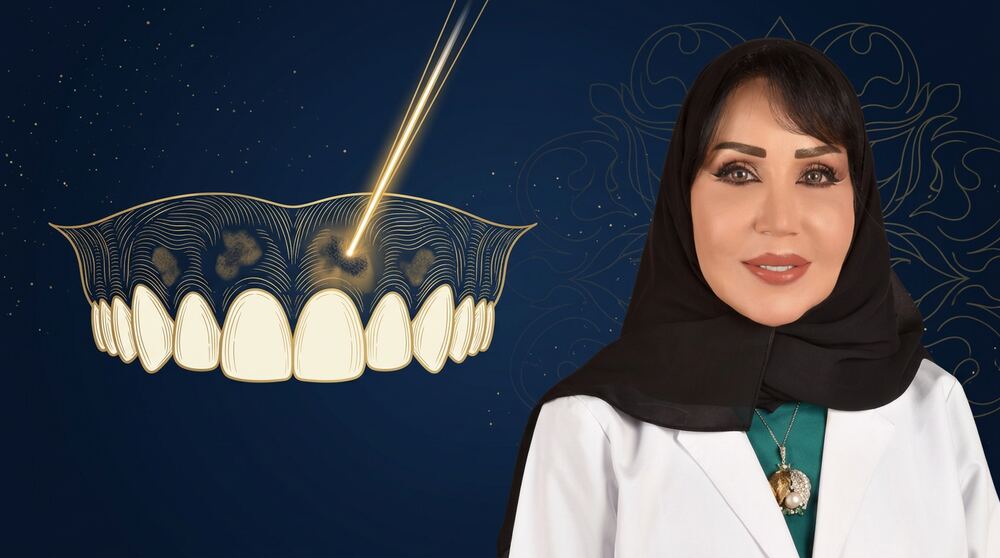 تصبّغات اللثة: الأسباب والعلاج