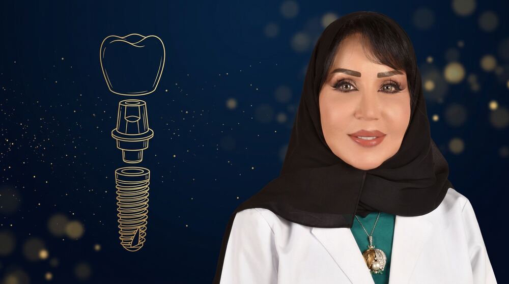تركيبات الزرعات: كيف تُثبَّت؟