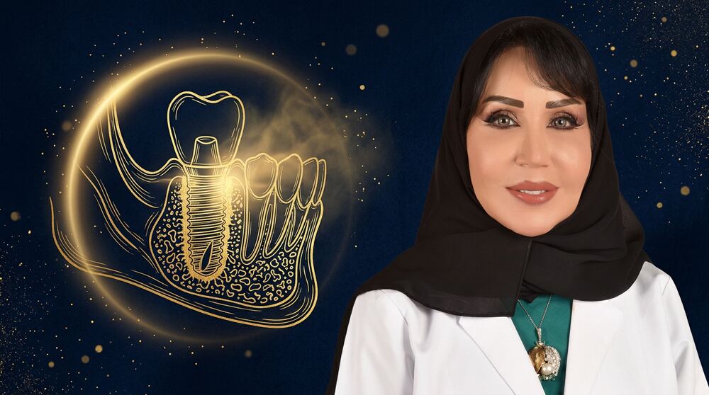 هل يرفض الجسم زرعة الأسنان؟