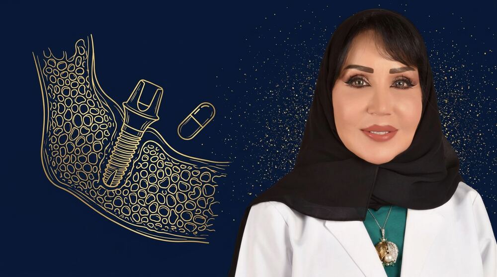 هشاشة العظام ونجاح زرعات الأسنان
