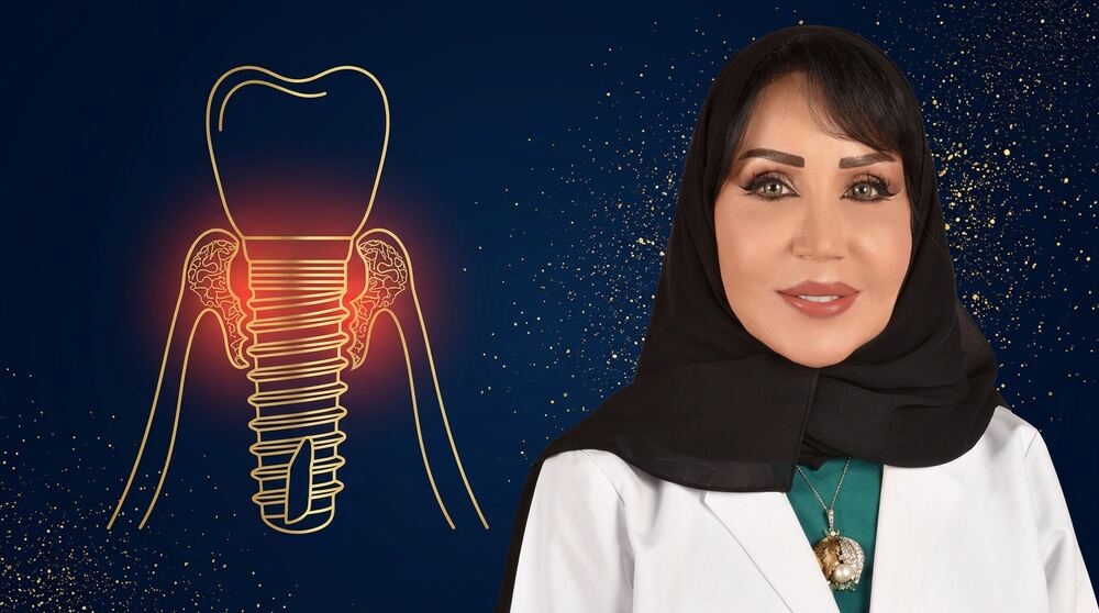 هل التهاب اللثة حول الزرعة يعني فشلها؟